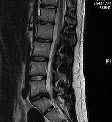 Diagnostic MRI